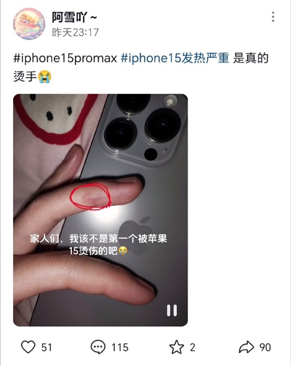 iPhone 15被投诉发热严重 苹果承认将软件修复：有人竟被烫伤 你怎么看？  第2张