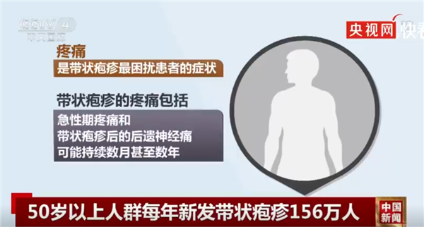 专家：民间流传缠腰龙缠一圈致命是谣言！带状疱疹可预防、治疗  第2张