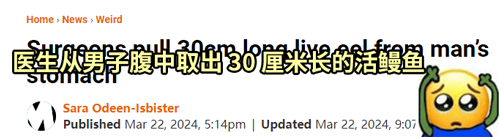 医生从患者肚子里扯出一条活鳗鱼 这不比异形还刺激  第2张