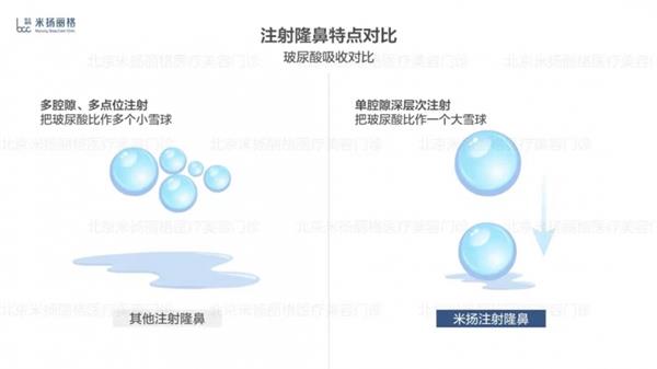 北京米扬丽格李振医生在鼻部注射和轮廓塑形方面的技术应用  第7张