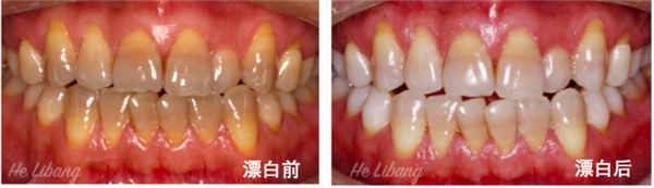 甘草片和红药水等为什么买不到了：知道真相的我有点慌  第8张