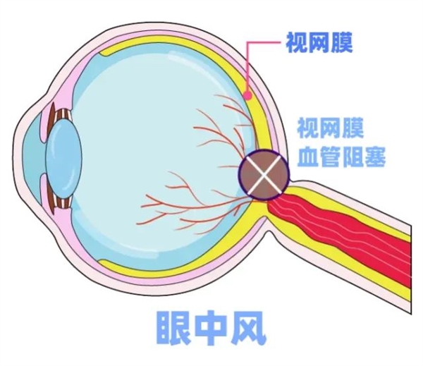 95后妈妈一觉醒来右眼失明！医生：已错过最佳抢救时机  第3张